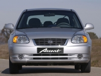 Hyundai Accent Hatchback 5-door. (LC) 1.3 MT (75hp) Technische Daten, Hyundai Accent Hatchback 5-door. (LC) 1.3 MT (75hp) Daten, Hyundai Accent Hatchback 5-door. (LC) 1.3 MT (75hp) Funktionen, Hyundai Accent Hatchback 5-door. (LC) 1.3 MT (75hp) Bewertung, Hyundai Accent Hatchback 5-door. (LC) 1.3 MT (75hp) kaufen, Hyundai Accent Hatchback 5-door. (LC) 1.3 MT (75hp) Preis, Hyundai Accent Hatchback 5-door. (LC) 1.3 MT (75hp) Autos