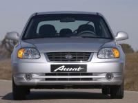 Hyundai Accent Hatchback 5-door. (LC) 1.5 MT (102hp) Technische Daten, Hyundai Accent Hatchback 5-door. (LC) 1.5 MT (102hp) Daten, Hyundai Accent Hatchback 5-door. (LC) 1.5 MT (102hp) Funktionen, Hyundai Accent Hatchback 5-door. (LC) 1.5 MT (102hp) Bewertung, Hyundai Accent Hatchback 5-door. (LC) 1.5 MT (102hp) kaufen, Hyundai Accent Hatchback 5-door. (LC) 1.5 MT (102hp) Preis, Hyundai Accent Hatchback 5-door. (LC) 1.5 MT (102hp) Autos